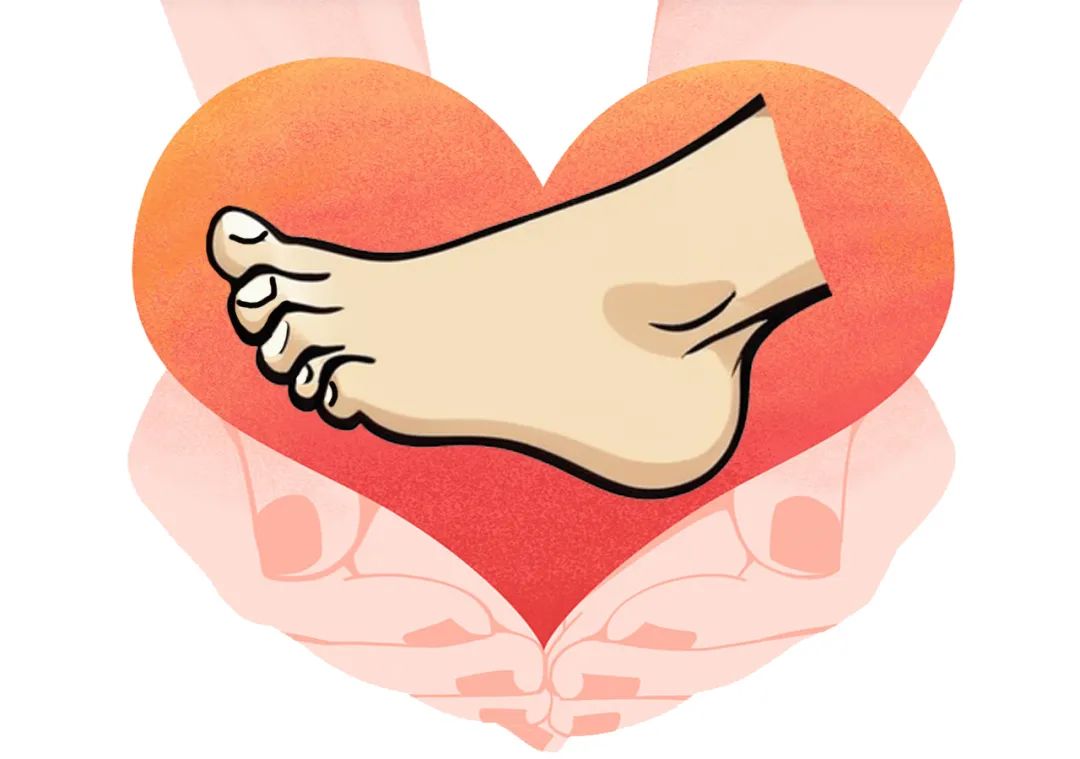 慢·创 —— 糖尿病足