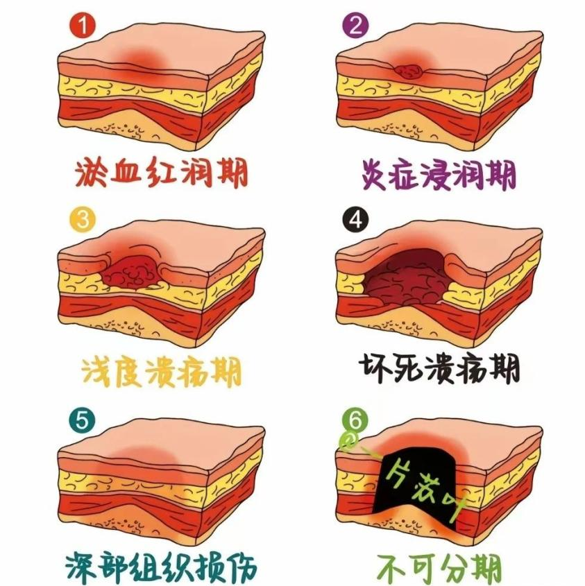 拒绝“压力山大